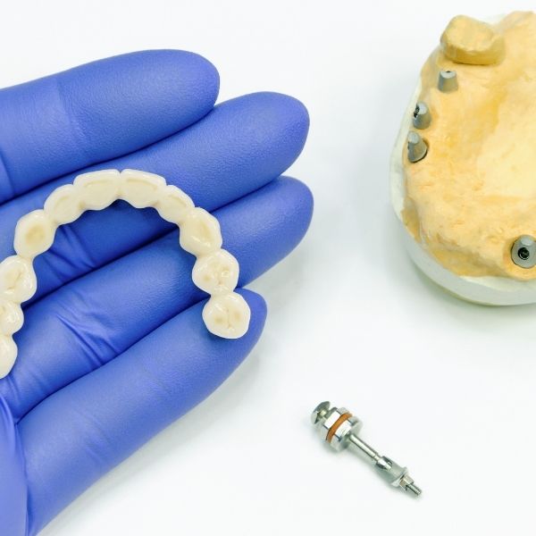 Protesis total sobre implantes / Dra Cristina Santa